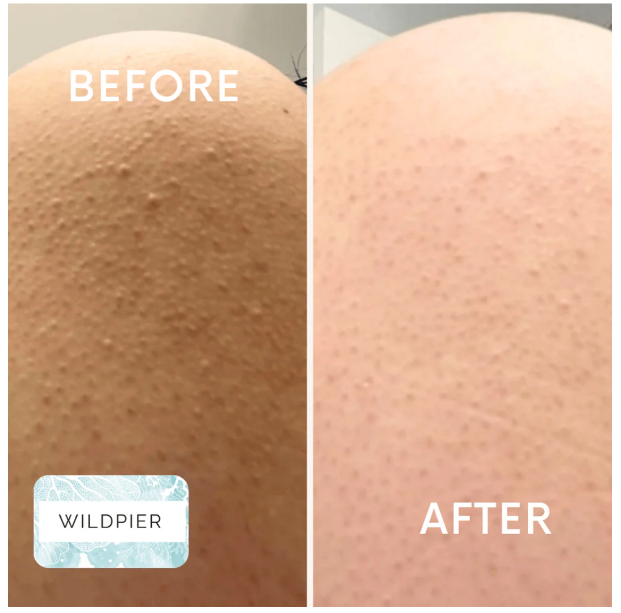 Luxe Deep Exfoliating Glove